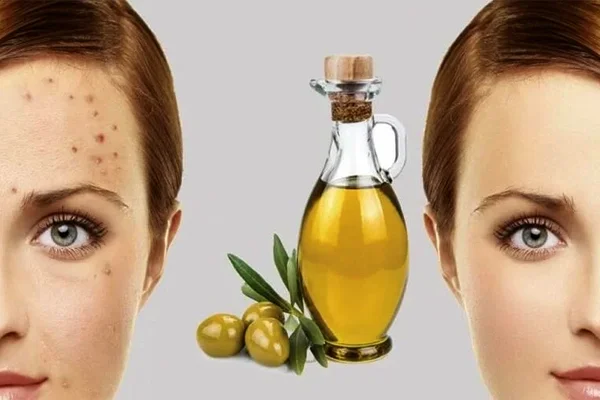 روغن زیتون برای پوست